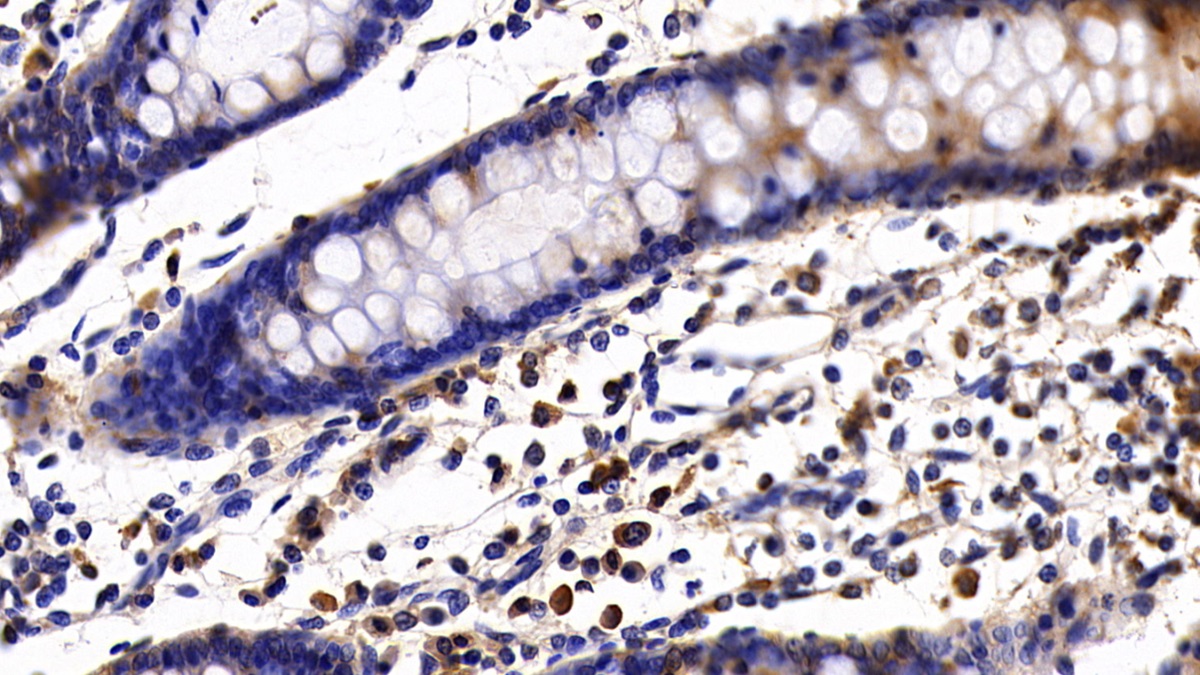 Polyclonal Antibody to Interleukin 18 Receptor 1 (IL18R1)