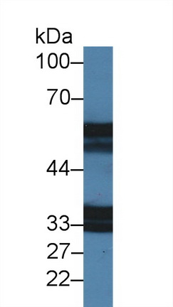 Polyclonal Antibody to Interleukin 18 Receptor 1 (IL18R1)