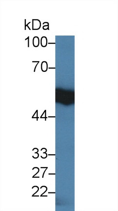 Polyclonal Antibody to Interleukin 18 Receptor 1 (IL18R1)