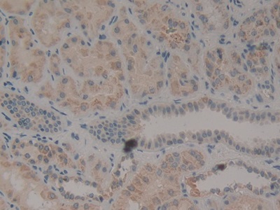 Polyclonal Antibody to Myostatin (MSTN)