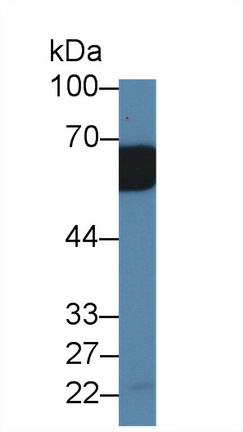 Polyclonal Antibody to Interleukin-18 Receptor Beta (IL18R Beta)