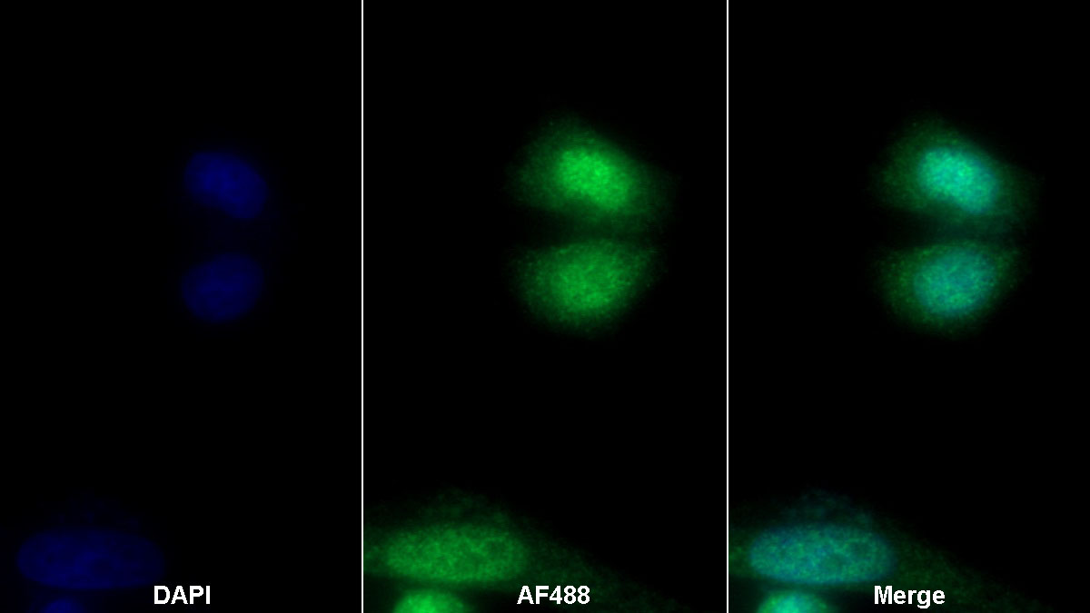 Polyclonal Antibody to Trefoil Factor 3 (TFF3)