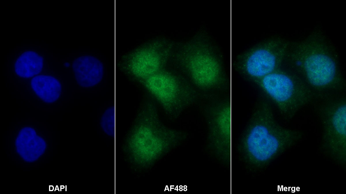 Polyclonal Antibody to Trefoil Factor 3 (TFF3)