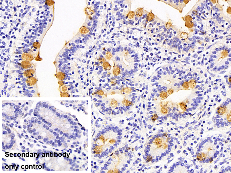 Polyclonal Antibody to Trefoil Factor 3 (TFF3)