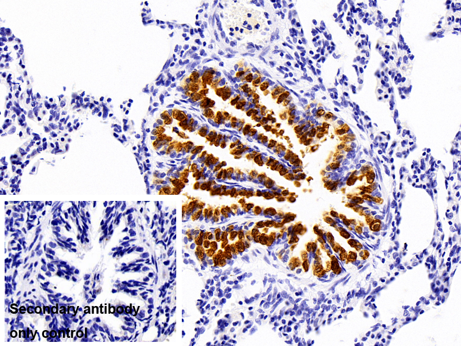 Polyclonal Antibody to Trefoil Factor 3 (TFF3)