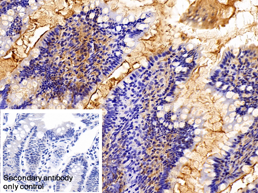 Polyclonal Antibody to Trefoil Factor 3 (TFF3)