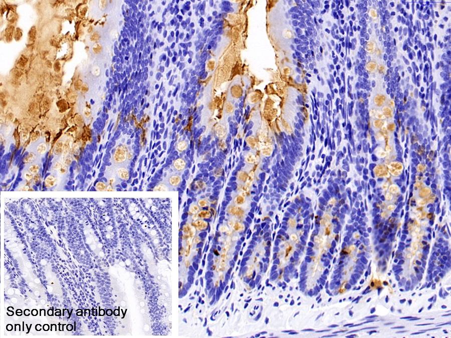 Polyclonal Antibody to Trefoil Factor 3 (TFF3)