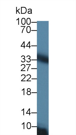 Polyclonal Antibody to Solute Carrier Family 25 Member 20 (SLC25A20)