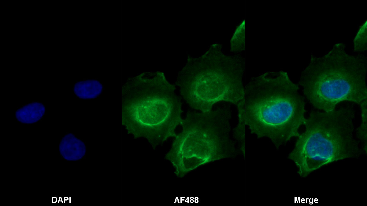 Polyclonal Antibody to Angiotensin II Receptor 1 (AGTR1)