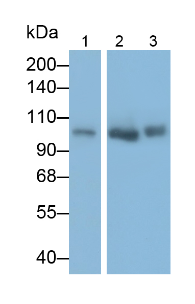 Polyclonal Antibody to Insulin Like Growth Factor 1 Receptor (IGF1R)