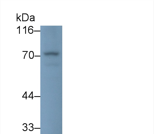 Polyclonal Antibody to Solute Carrier Family 27 Member 5 (SLC27A5)