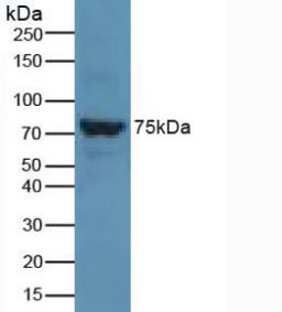 Polyclonal Antibody to Solute Carrier Family 27 Member 5 (SLC27A5)