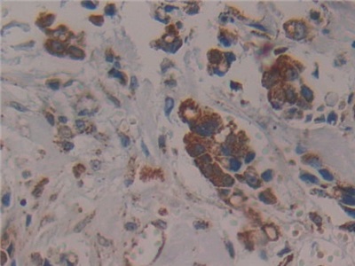 Polyclonal Antibody to Citrate Synthase (CS)