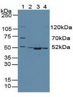 Polyclonal Antibody to Citrate Synthase (CS)