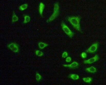 Polyclonal Antibody to Citrate Synthase (CS)