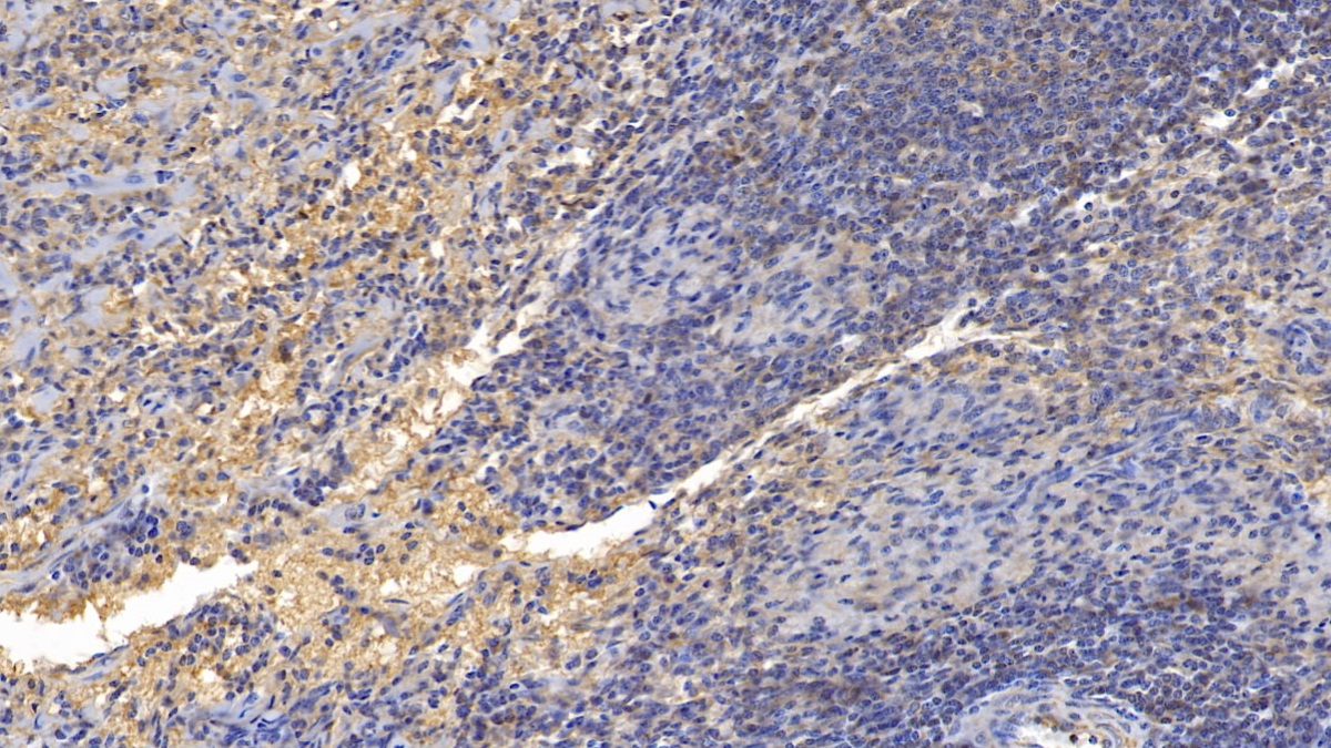 Polyclonal Antibody to Glucocorticoid Induced Tumor Necrosis Factor Receptor (GITR)