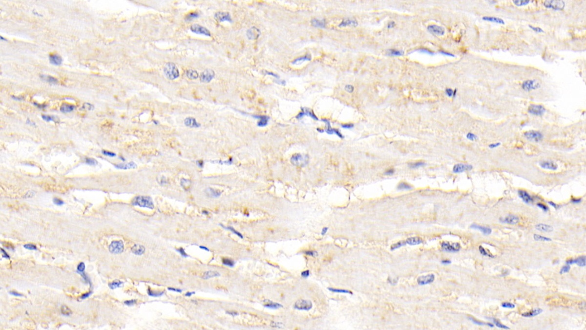 Polyclonal Antibody to Titin (TTN)