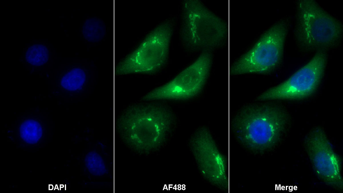 Polyclonal Antibody to Golgi Phosphoprotein 2 (GOLPH2)