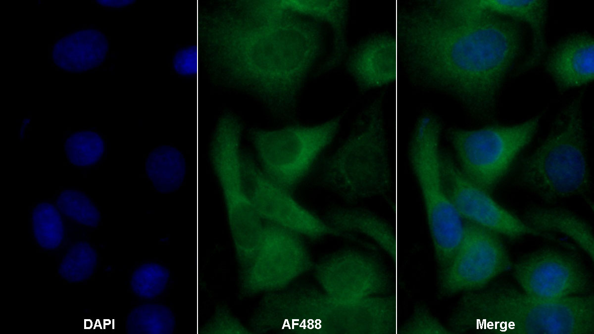 Polyclonal Antibody to Cluster Of Differentiation 146 (CD146)