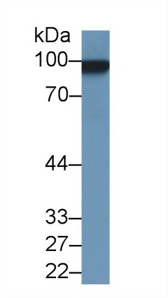 Polyclonal Antibody to Cluster Of Differentiation 146 (CD146)