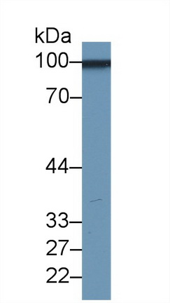 Polyclonal Antibody to Cluster Of Differentiation 146 (CD146)