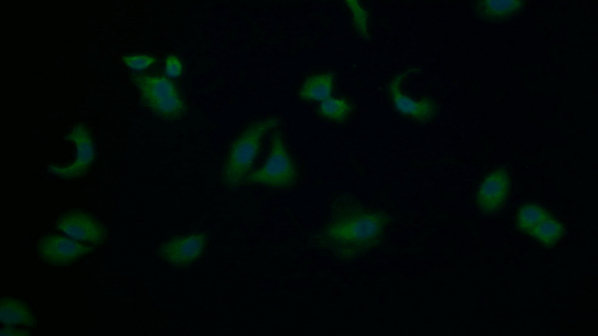 Polyclonal Antibody to Protein Kinase, AMP Activated Beta 1 (PRKAb1)