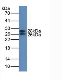 Polyclonal Antibody to Insulin Like Growth Factor Binding Protein 7 (IGFBP7)