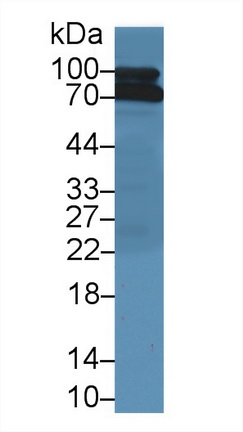 Polyclonal Antibody to Complement Component 1, S Subcomponent (C1s)