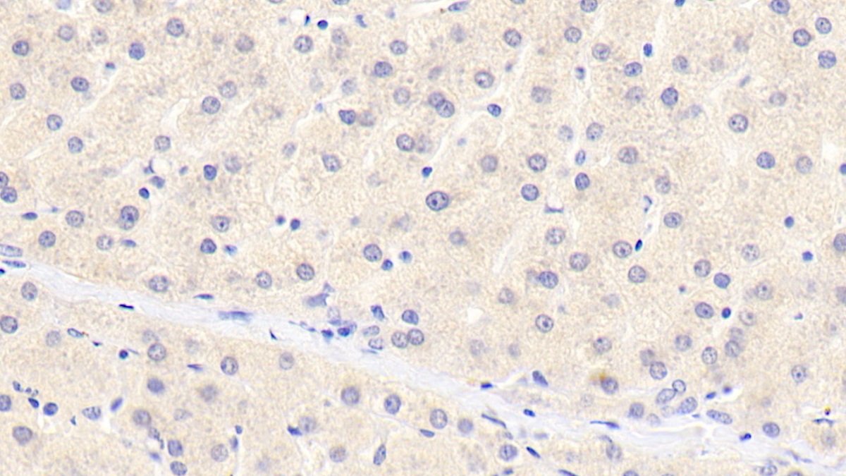 Polyclonal Antibody to Complement Component 1, S Subcomponent (C1s)