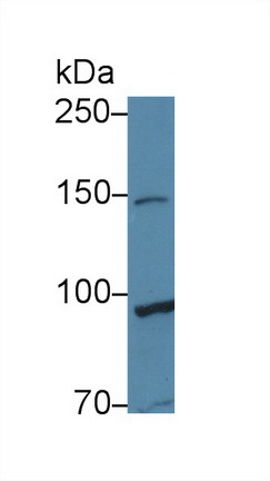 Polyclonal Antibody to TATA Box Binding Protein Associated Factor 2 (TAF2)