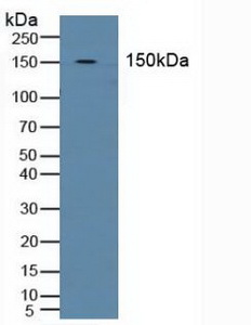 Polyclonal Antibody to Band 3 (BND3)