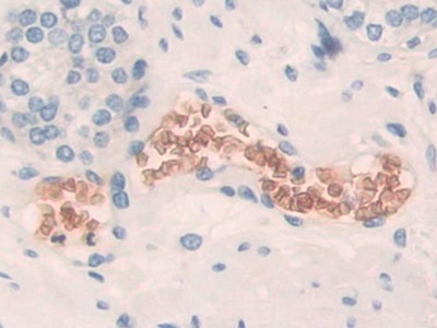 Polyclonal Antibody to Band 3 (BND3)