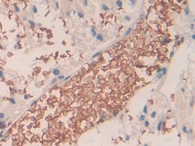 Polyclonal Antibody to Band 3 (BND3)