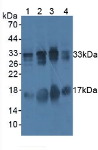 Polyclonal Antibody to B-Cell Activating Factor (BAFF)