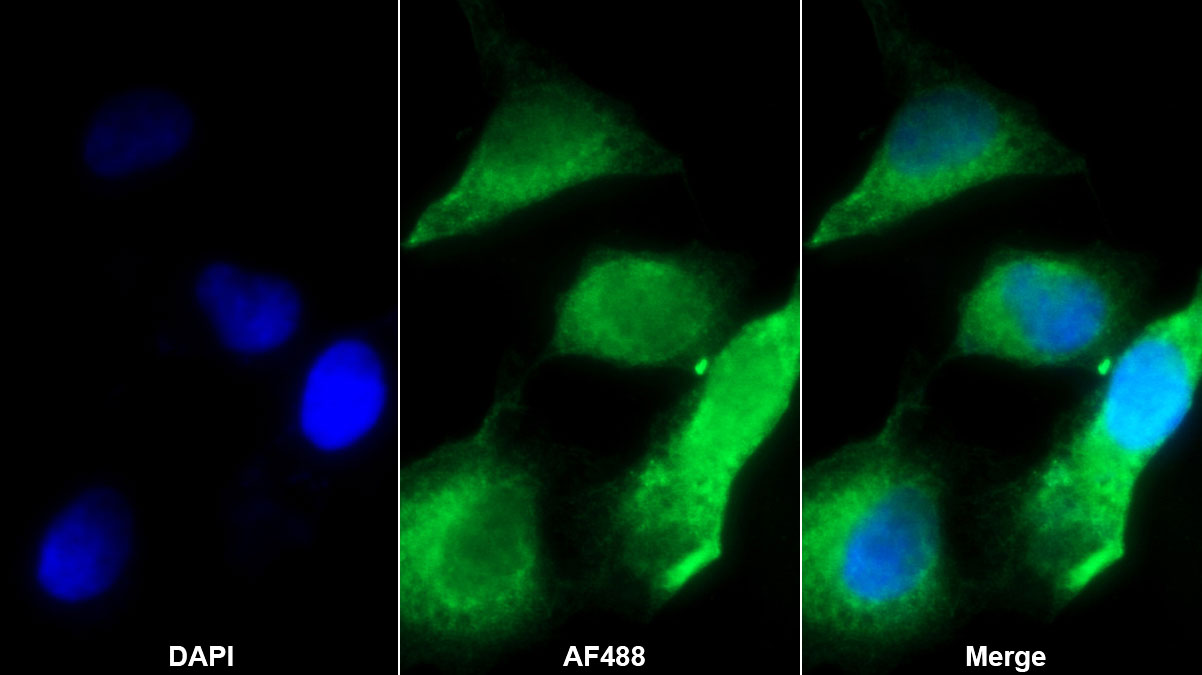 Polyclonal Antibody to B-Cell Activating Factor (BAFF)