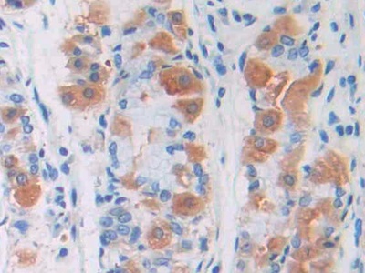 Polyclonal Antibody to Permeability Glycoprotein (Pgp)