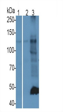 Polyclonal Antibody to Permeability Glycoprotein (Pgp)