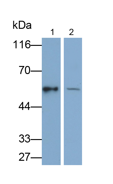 Polyclonal Antibody to Cytokeratin 10 (CK10)