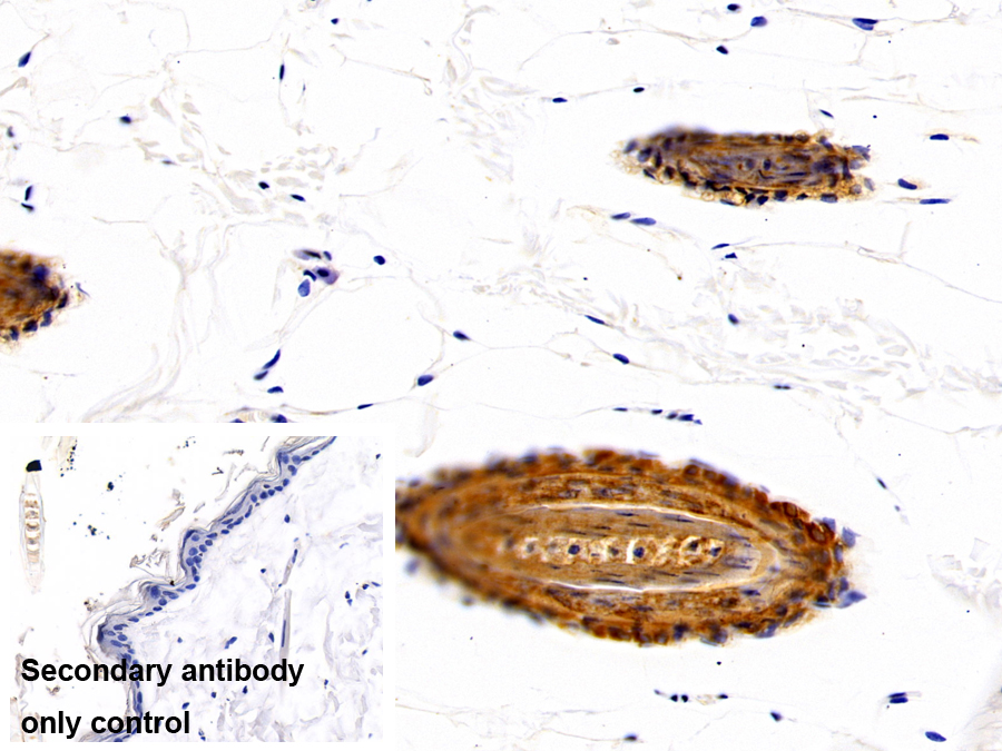 Polyclonal Antibody to Cytokeratin 10 (CK10)