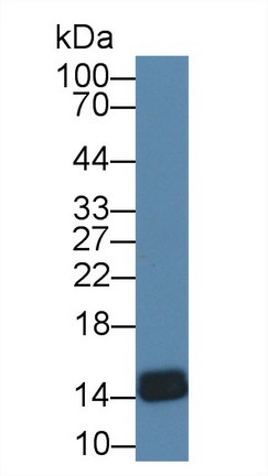 Polyclonal Antibody to Fatty Acid Binding Protein 4 (FABP4)