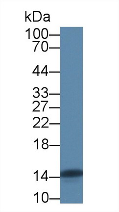 Polyclonal Antibody to Fatty Acid Binding Protein 4 (FABP4)