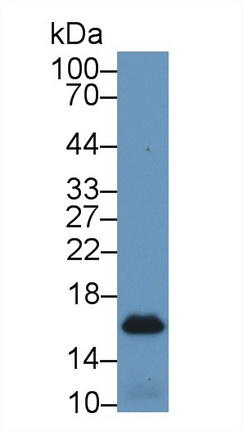 Polyclonal Antibody to Fatty Acid Binding Protein 4 (FABP4)