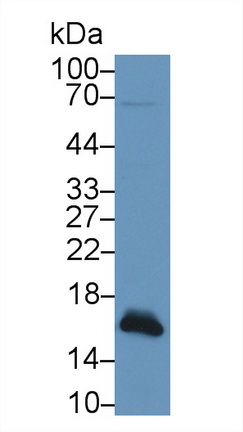 Polyclonal Antibody to Fatty Acid Binding Protein 4 (FABP4)