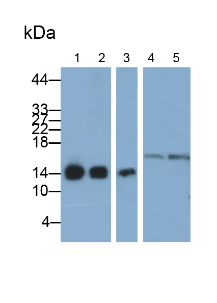 Polyclonal Antibody to Fatty Acid Binding Protein 4 (FABP4)