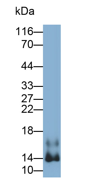 Polyclonal Antibody to Fatty Acid Binding Protein 4 (FABP4)