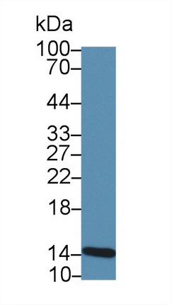 Polyclonal Antibody to Fatty Acid Binding Protein 4 (FABP4)