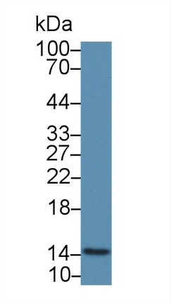 Polyclonal Antibody to Fatty Acid Binding Protein 4 (FABP4)