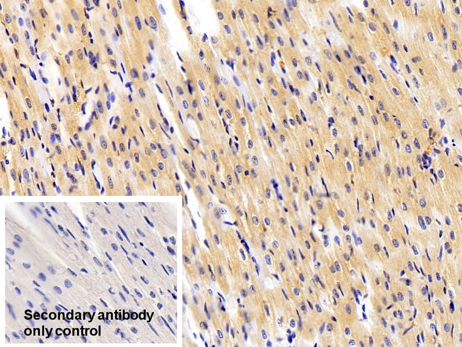 Polyclonal Antibody to Fatty Acid Binding Protein 4 (FABP4)