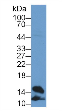 Polyclonal Antibody to Fatty Acid Binding Protein 4 (FABP4)