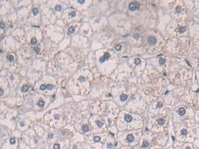 Polyclonal Antibody to Interleukin 25 (IL25)